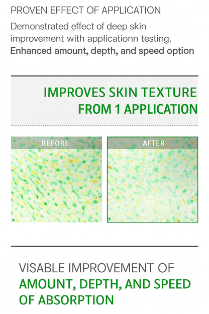 VT COSMETICS CICA Reedle Shot 300 (50ml) The Pore-Tightening Essence